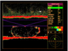 WESMAR TCS 335 Trawl Sonar